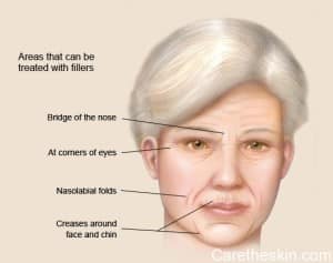 Skin-wrinkles
